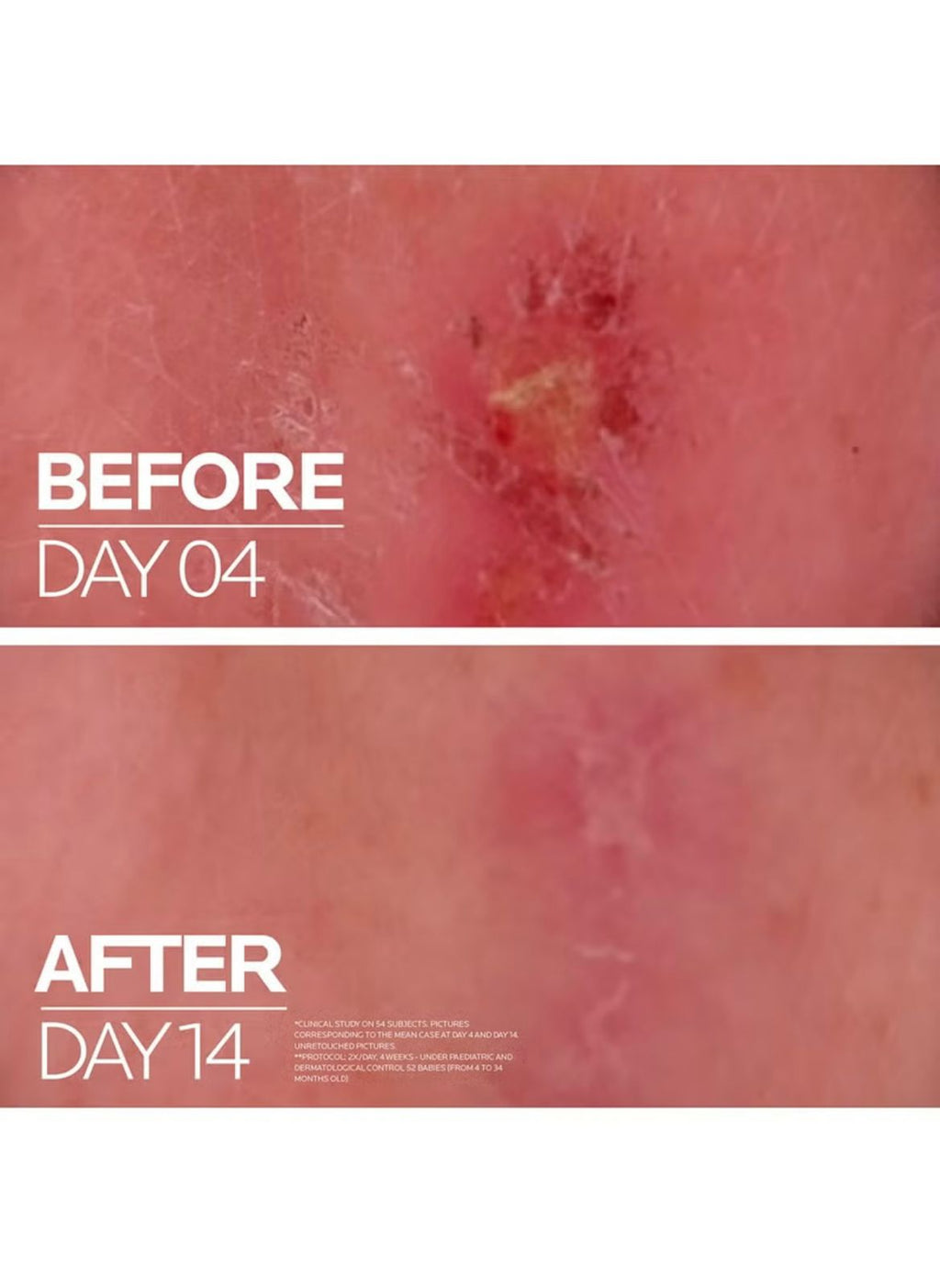 LA ROCHE -POSY CICAPLAST B5+ 100ML