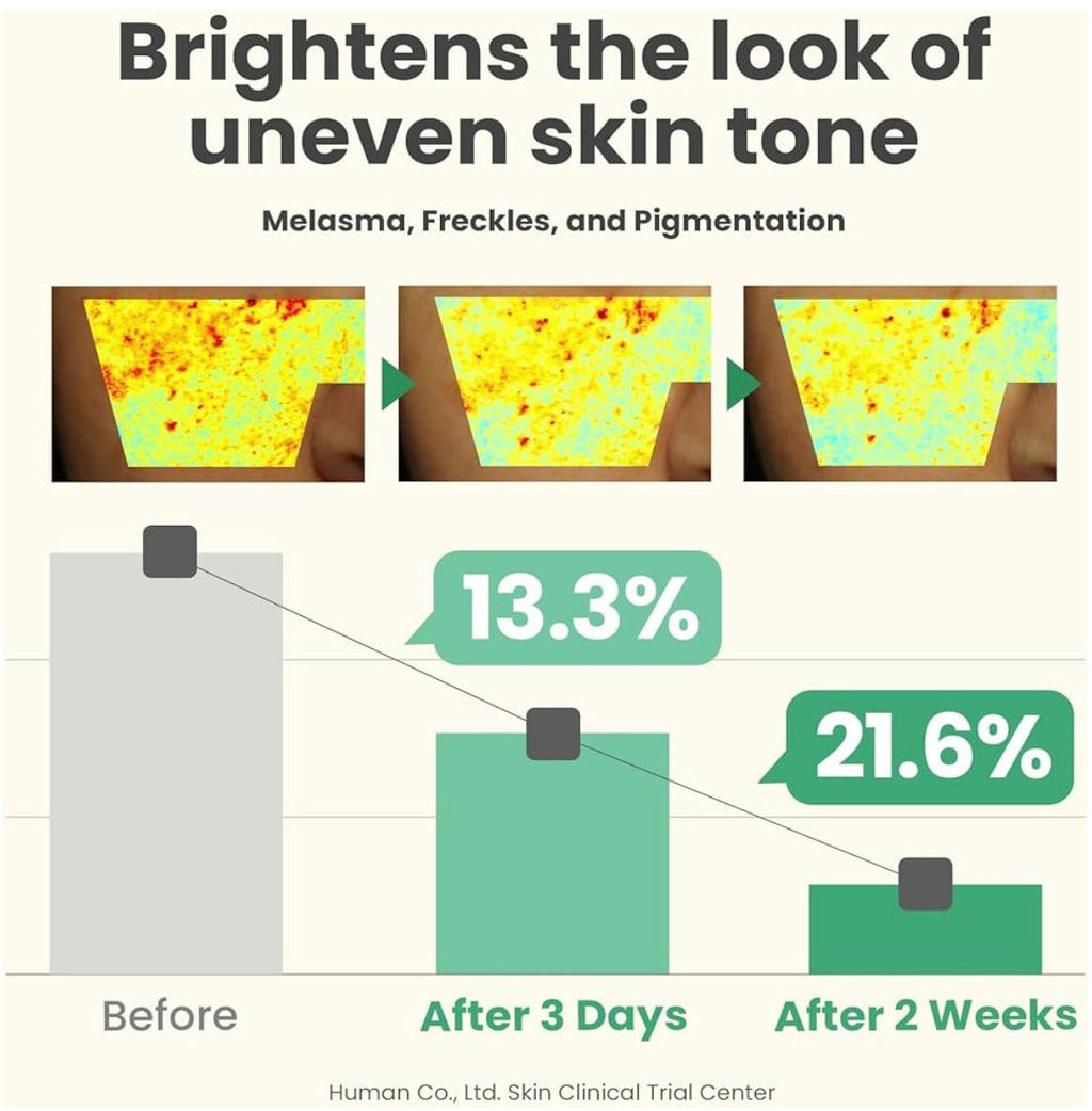 AXIS-Y Dark Spot Correcting Glow Serum (50ml) – Brighten, Hydrate & Even Out Skin Tone