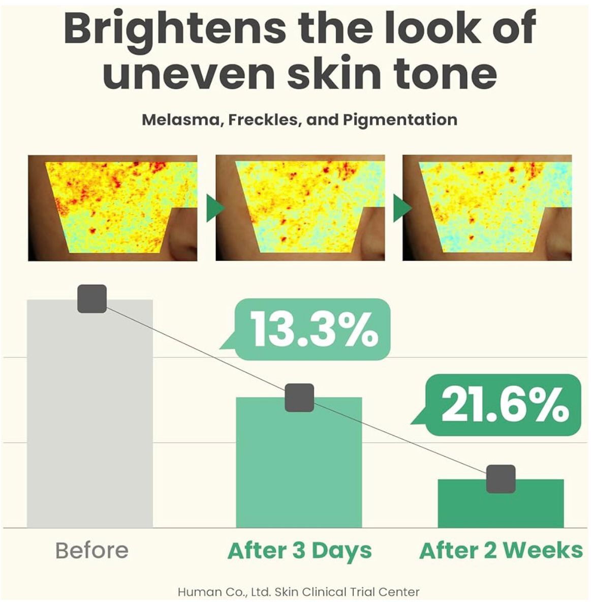 AXIS-Y Dark Spot Correcting Glow Serum (50ml) – Brighten, Hydrate & Even Out Skin Tone